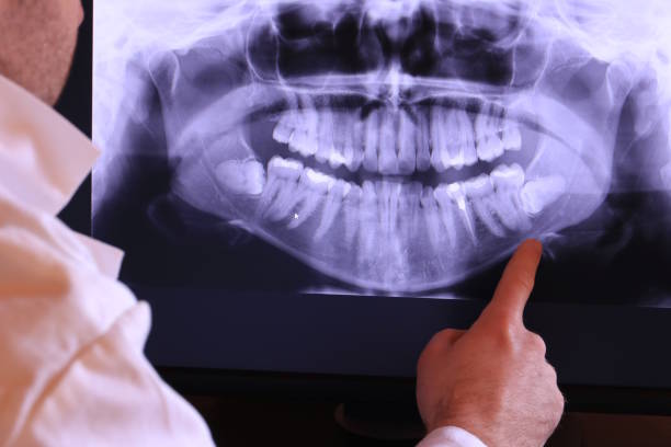 Best Emergency Dentist for Knocked-Out Tooth in Alhambra, CA